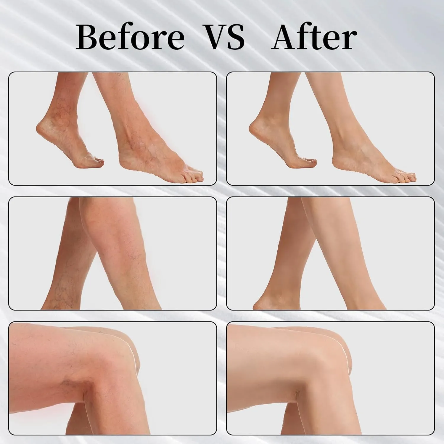 2 Pairs 20-30mmHg Compression Stockings for Women & Men, MumMarmot's Thigh High Compression Socks with Silicone Dot Band, Graduated Support Compression Stockings for Edema Varicose Veins