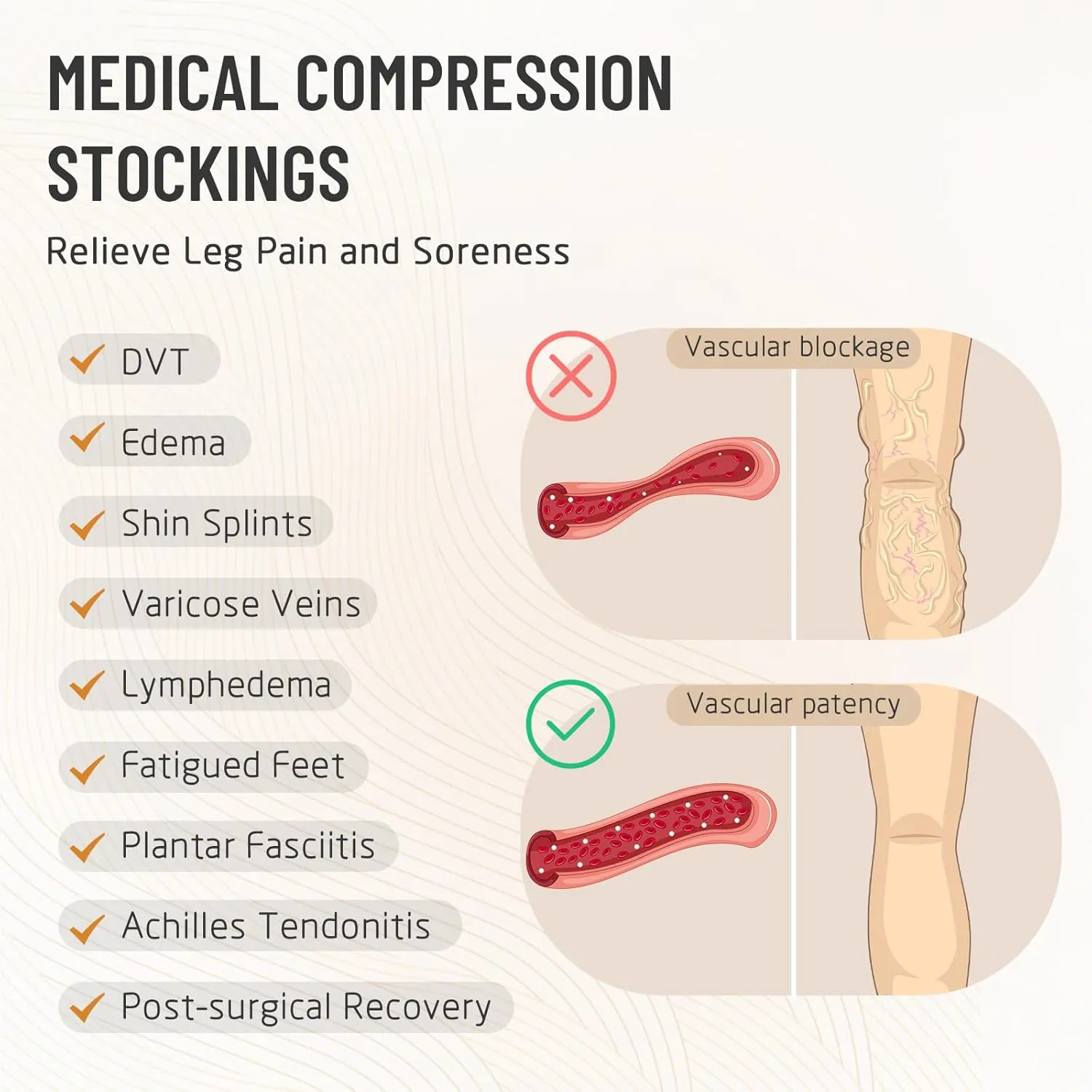 Thigh High 15-20 mmHg Compression Stocking, Open Toe Compression Socks for women & men circulation with Silicone Dot Band-Ideal for Athletic, Medical, Travel Use
